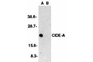 Western Blotting (WB) image for anti-Cell Death-Inducing DFFA-Like Effector A (CIDEA) (C-Term) antibody (ABIN1030333) (CIDEA 抗体  (C-Term))