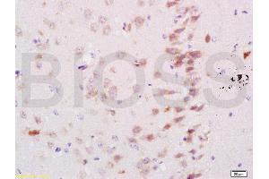 Formalin-fixed and paraffin embedded mouse brain labeled with Rabbit Anti Neurocan Polyclonal Antibody, Unconjugated (ABIN737001) at 1:200 followed by conjugation to the secondary antibody and DAB staining (Neurocan 抗体  (AA 1185-1257))