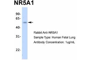Western Blotting (WB) image for anti-Nuclear Receptor Subfamily 5, Group A, Member 1 (NR5A1) (Middle Region) antibody (ABIN2777447)