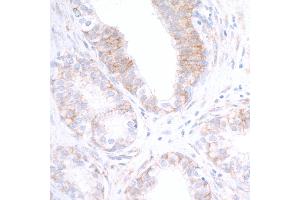 Immunohistochemistry (IHC) image for anti-Poliovirus Receptor-Related 2 (Herpesvirus Entry Mediator B) (PVRL2) (AA 50-100) antibody (ABIN7449542)