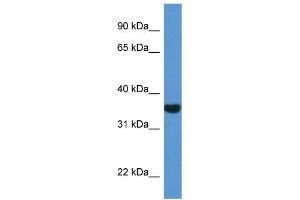 WB Suggested Anti-NQO1 AntibodyTitration: 1. (NQO1 抗体  (C-Term))