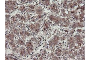 Image no. 8 for anti-Diphthamide Biosynthesis Protein 2 (DPH2) antibody (ABIN1497893)