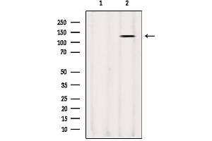 Western blot analysis of extracts from Sp2/0, using LRPPRC Antibody. (LRPPRC 抗体  (Internal Region))