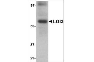 Western blot analysis of LGI3 in human brain tissue lysate with this product at 1 μg/ml. (LGI3 抗体  (Center))