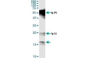 Western Blotting (WB) image for POLR1D (Human) IP-WB Antibody Pair (ABIN1343300)