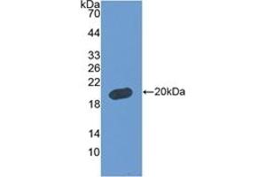 Detection of Recombinant FBLN5, Human using Polyclonal Antibody to Fibulin 5 (FBLN5) (Fibulin 5 抗体  (AA 99-205))