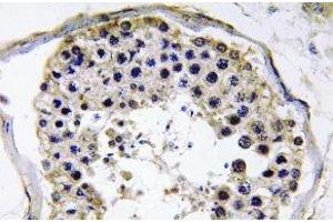 Immunohistochemistry (IHC) analyzes of TRAF6 antibody in paraffin-embedded human testis tissue. (TRAF6 抗体)