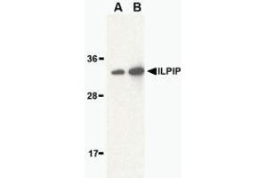 Western blot analysis of ILPIP in human brain lysate with AP30431PU-N ILPIP antibody at (A) 1 and (B) 2 μg/ml. (STRADB 抗体  (Intermediate Domain))