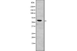 Western blot analysis of SF3A3 expression in Human fetal liver lysates,The lane on the left is treated with the antigen-specific peptide. (SF3A3 抗体  (Internal Region))