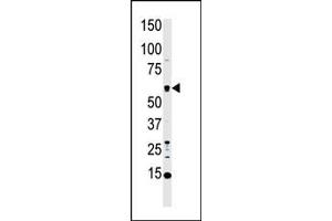 Western Blotting (WB) image for anti-Macrophage Stimulating 1 (Hepatocyte Growth Factor-Like) (MST1) (AA 385-415), (C-Term) antibody (ABIN392427)