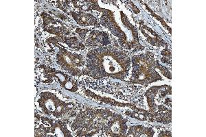 IHC analysis of GPCR RDC1/CXCR-7/ACKR3 using anti-GPCR RDC1/CXCR-7/ACKR3 antibody (ABIN7602889). (CXCR7 抗体  (C-Term))