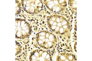 Immunohistochemistry (IHC) image for anti-X-Ray Repair Complementing Defective Repair in Chinese Hamster Cells 3 (XRCC3) (AA 62-346) antibody (ABIN3023006)