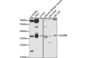 Western blot analysis of extracts of various cell lines, using IL10RB antibody (ABIN7267983) at 1:1000 dilution. (IL10RB 抗体  (AA 20-220))