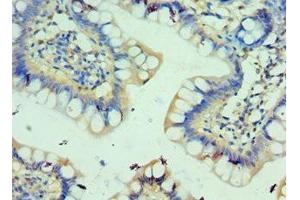 Immunohistochemistry of paraffin-embedded human small intestine tissue using ABIN7146163 at dilution of 1:100 (C3AR1 抗体  (AA 160-340))