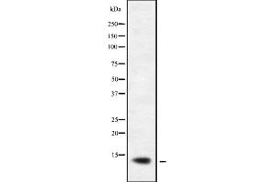 Western blot analysis of XCL1/2 using K562 whole cell lysates (XCL1/XCL2 抗体)