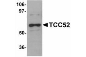 Image no. 1 for anti-DDB1 and CUL4 Associated Factor 12 (DCAF12) (C-Term) antibody (ABIN478276) (DCAF12 抗体  (C-Term))