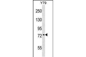 Western blot analysis in Y79 cell line lysates (35ug/lane). (KATNB1 抗体  (AA 331-359))