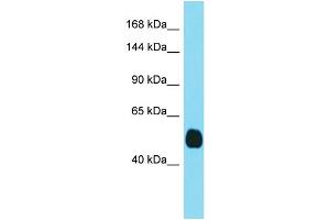 Host: Rabbit  Target Name: Tmprss3  Sample Tissue: Mouse Kidney lysates  Antibody Dilution: 1. (TMPRSS3 抗体  (C-Term))