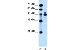 Image no. 2 for anti-Indian Hedgehog (IHH) (AA 24-73) antibody (ABIN205075) (Indian Hedgehog 抗体  (AA 24-73))