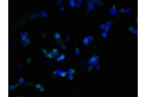 Immunofluorescence (IF) image for anti-Zinc Finger, DHHC-Type Containing 23 (ZDHHC23) (AA 187-302) antibody (ABIN7162546)