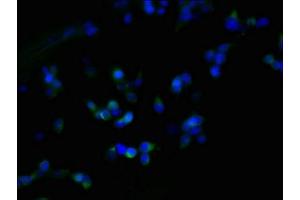Immunofluorescent analysis of 293T cells using ABIN7162546 at dilution of 1:100 and Alexa Fluor 488-congugated AffiniPure Goat Anti-Rabbit IgG(H+L) (ZDHHC23 抗体  (AA 187-302))