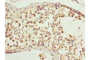 Immunohistochemistry of paraffin-embedded human testis tissue using ABIN7147764 at dilution of 1:100 (WDR16 抗体  (AA 101-400))