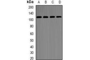 Western blot analysis of Hexokinase 2 expression in SHSY5Y (A), MCF7 (B), K562 (C), COS7 (D) whole cell lysates. (Hexokinase 2 抗体)