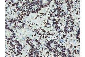 Image no. 18 for anti-Non-POU Domain Containing, Octamer-Binding (NONO) (AA 184-385) antibody (ABIN1491073)