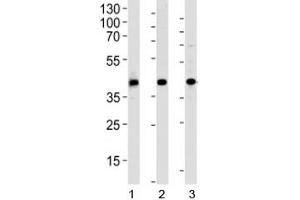 Western blot analysis of 1) human HepG2, 2) mouse kidney and 3) rat spleen tissue lysate using ACADL antibody at 1:1000. (ACADL 抗体  (AA 14-43))