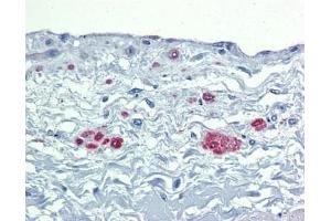 SOX7 antibody was used for immunohistochemistry at a concentration of 4-8 ug/ml. (SOX7 抗体  (Middle Region))