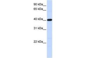 Image no. 1 for anti-Tropomodulin 3 (TMOD3) (AA 36-85) antibody (ABIN6741279) (TMOD3 抗体  (AA 36-85))