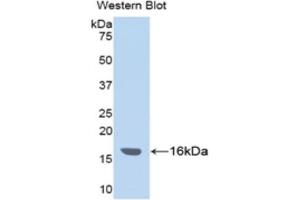 WB of Protein Standard: different control antibodies  against Highly purified E. (ITIH4 ELISA 试剂盒)