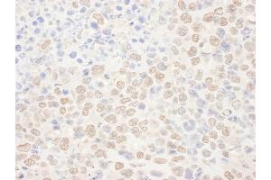 Immunohistochemistry (IHC) image for anti-N-Acetyltransferase 10 (GCN5-Related) (NAT10) (AA 650-700) antibody (ABIN7455028)