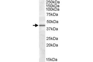CAMK1D polyclonal antibody  (0. (CAMK1D 抗体)