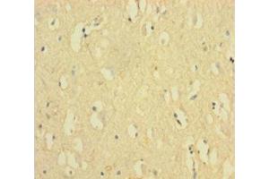 Immunohistochemistry of paraffin-embedded human brain tissue using ABIN7152548 at dilution of 1:100 (FANCD2 抗体  (AA 1-291))