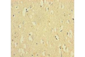 Immunohistochemistry of paraffin-embedded human brain tissue using ABIN7152548 at dilution of 1:100 (FANCD2 抗体  (AA 1-291))