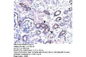 Human kidney (PAWR 抗体  (Middle Region))