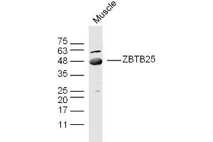 Mouse muscle lysates probed with ZBTB25/ZNF46 Polyclonal Antibody, unconjugated  at 1:300 overnight at 4°C followed by a conjugated secondary antibody at 1:10000 for 90 minutes at 37°C. (ZBTB25 抗体  (AA 341-435))