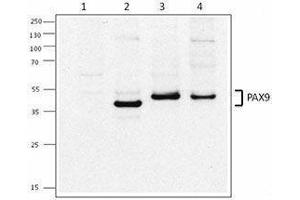 Western Blotting (WB) image for anti-Paired Box 9 (PAX9) antibody (ABIN2665320) (PAX9 抗体)
