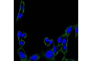 Immunofluorescence analysis of B16 cells using FAK mouse mAb (green). (FAK 抗体)