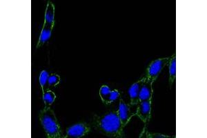 Immunofluorescence analysis of B16 cells using FAK mouse mAb (green). (FAK 抗体)