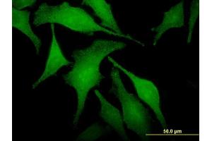 Immunofluorescence of monoclonal antibody to SNX6 on HeLa cell. (SNX6 抗体  (AA 1-290))