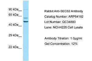 Western Blotting (WB) image for anti-Translocation Protein 1 (TLOC1) (Middle Region) antibody (ABIN2774392) (SEC62 抗体  (Middle Region))