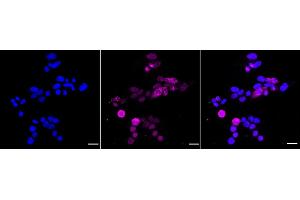 anti-Myeloid Differentiation Primary Response Gene (88) (MYD88) antibody