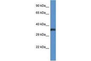 Image no. 1 for anti-Phosphatidylinositol Glycan C (PIGC) (C-Term) antibody (ABIN6746921) (PIGC 抗体  (C-Term))