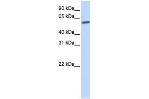SENP3 antibody used at 1 ug/ml to detect target protein. (SENP3 抗体  (N-Term))