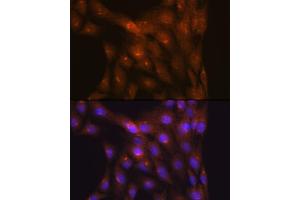 Immunofluorescence analysis of C6 cells using NDUFS4 Rabbit mAb (ABIN7268821) at dilution of 1:100 (40x lens).
