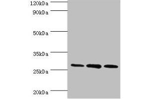 Western blot All lanes: ORC6 antibody at 16 μg/mL Lane 1: Mouse spleen tissue Lane 2: MCF-7 whole cell lysate Lane 3: Hela whole cell lysate Secondary Goat polyclonal to rabbit IgG at 1/10000 dilution Predicted band size: 28 kDa Observed band size: 28 kDa