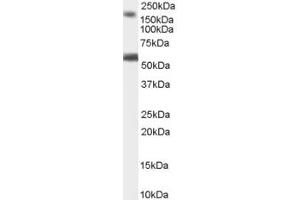 ABIN184627 staining (1µg/ml) of Human Brain (Cerebellum) lysate (RIPA buffer, 35µg total protein per lane). (BAIAP2 抗体  (C-Term))