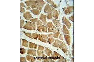 CN3 Antibody (C-term) 9817b IHC analysis in formalin fixed and paraffin embedded skeletal muscle followed by peroxidase conjugation of the secondary antibody and DAB staining. (Calpain 3 抗体  (C-Term))